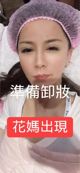  【活力滿點滴】自強星和診所（竹北）- 一乾就想到細紋、斑斑點點、老態 太可怕了，趕緊來預約一下！～-陳小丸